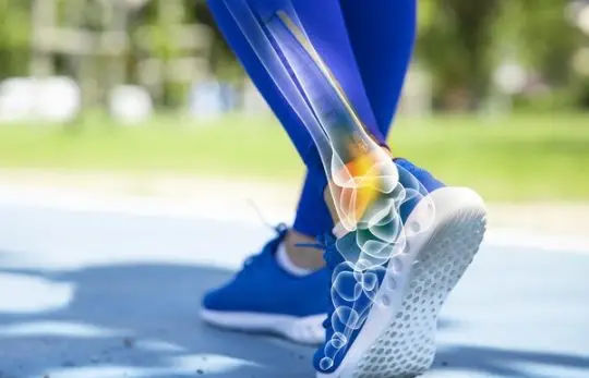 Choosing the Optimal Running Shoes for Achilles Tendon Concerns