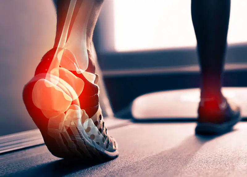 The Best Running Shoes for Achilles Tendonitis A Comprehensive Guide